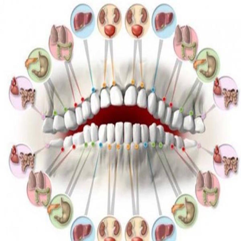 علاقة الأسنان بالالام