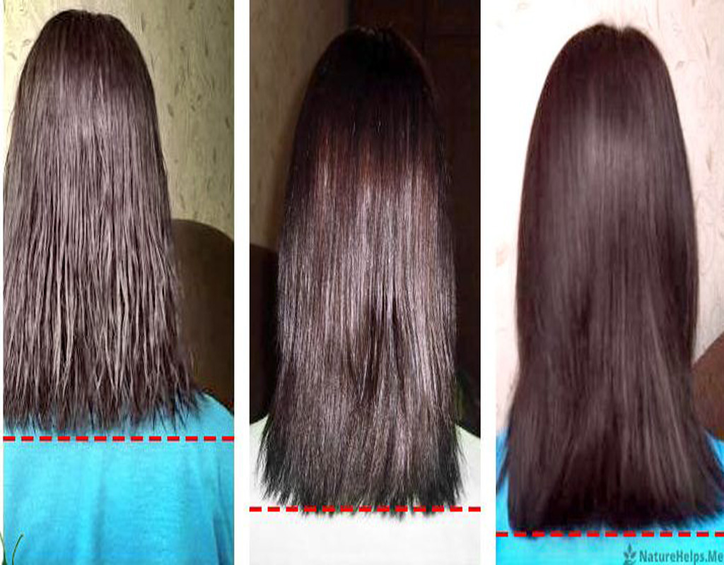 cayenne-pepper-hair-growth-before-after-2