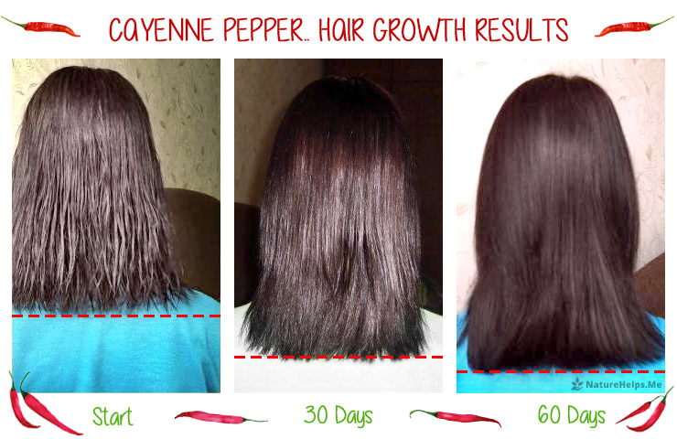 cayenne-pepper-hair-growth-before-after-2