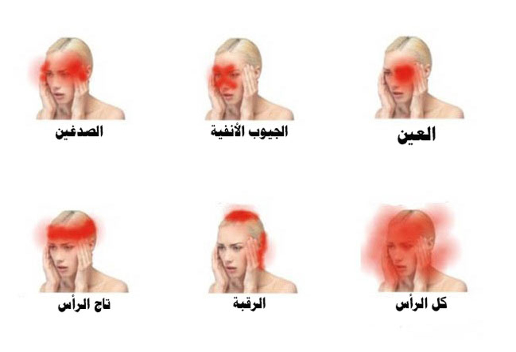 5 أنواع من أوجاع الرأس قد تشير إلى وجود مرض خطير - التربية الذكية